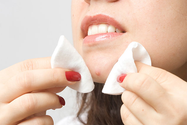 Image of women about to squeeze a pimple on chin.