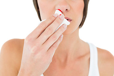 Image of a nose bleed.