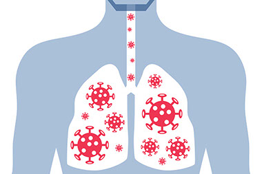 Illustration of lungs with MERS.