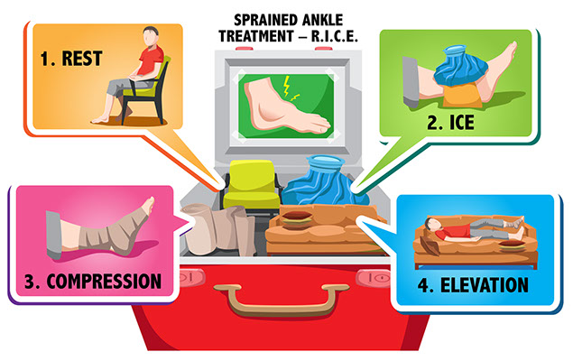 Illustration showing treatment for a sprained ankle using R.I.C.E.