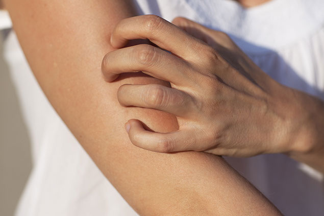 Close up image of person itching arm.