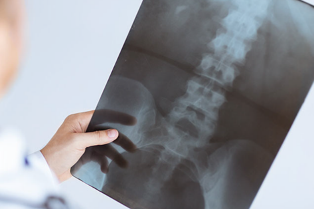 Doctor holding an x-ray film.