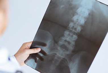 Doctor holding an x-ray film.